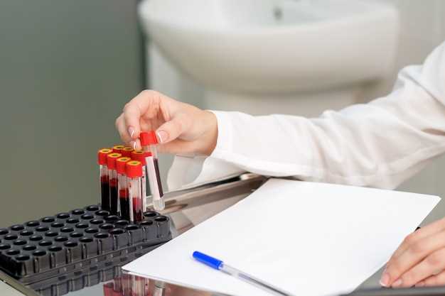Анализ на сворачиваемость крови: методы и значение