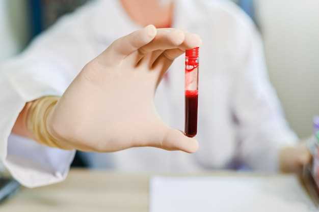 Значение анализа сворачиваемости крови