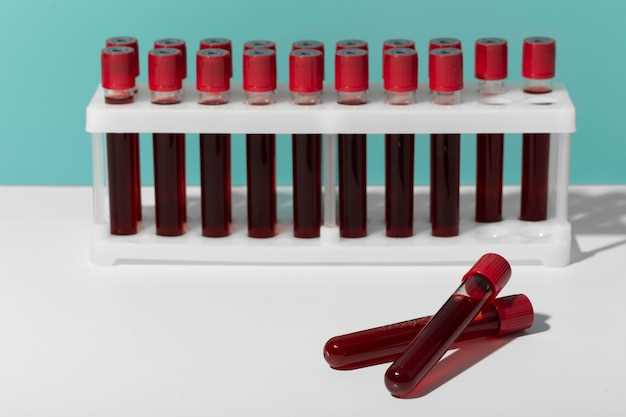 Что нужно знать о подготовке к сдаче анализов крови из вены