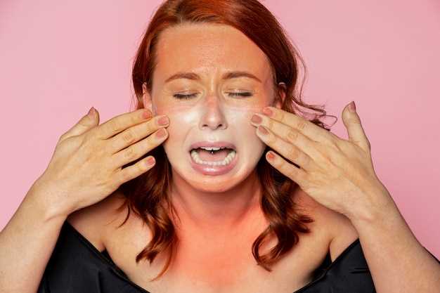 Эффективные методы устранения белесого подкожного воспаления на лице