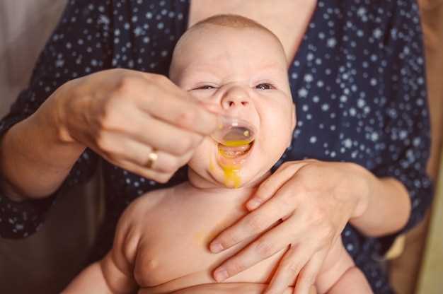Домашние методы самостоятельно справиться с желтушкой у новорожденных