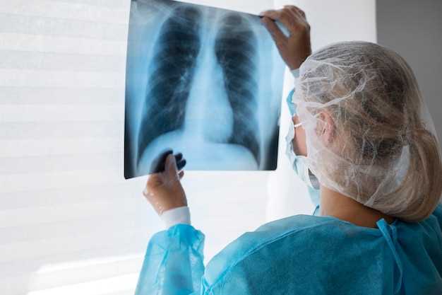 Характерные признаки пневмонии на рентгенограмме