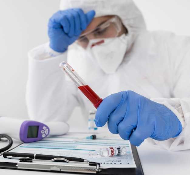 Как проводится общий анализ крови для обнаружения ВИЧ
