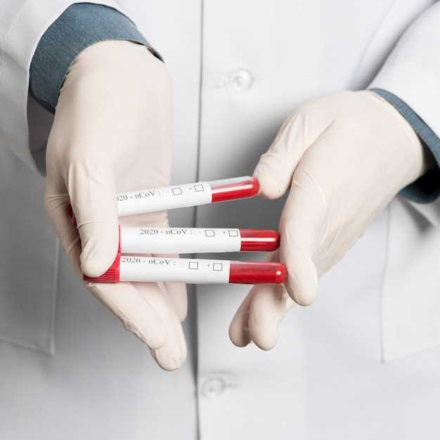 Как подготовиться к клиническому анализу крови?