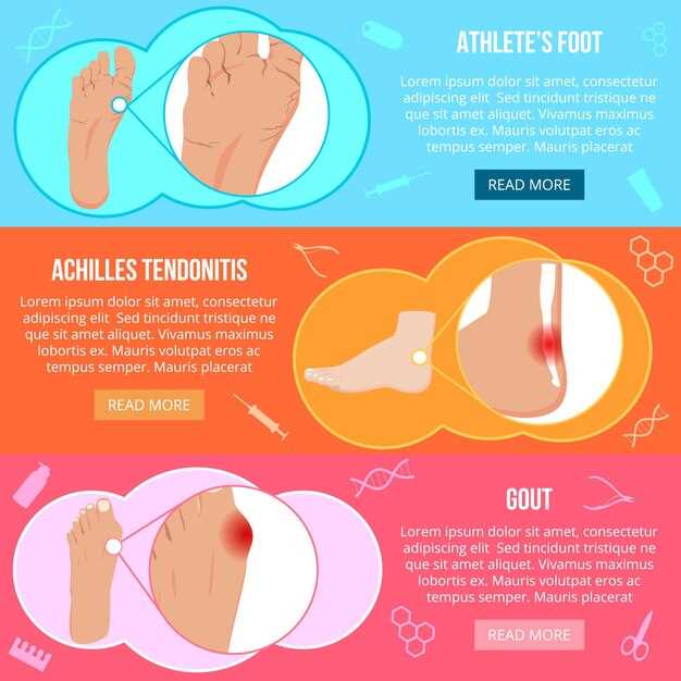 Симптомы и диагностика грибка между пальцами ног