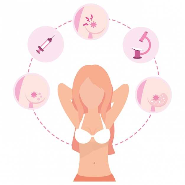 Роль прогестерона в формировании мастопатии