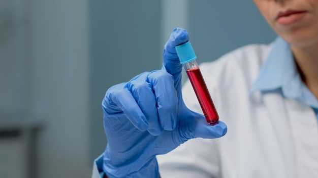 Почему исследование крови важно для определения брюшного тифа?