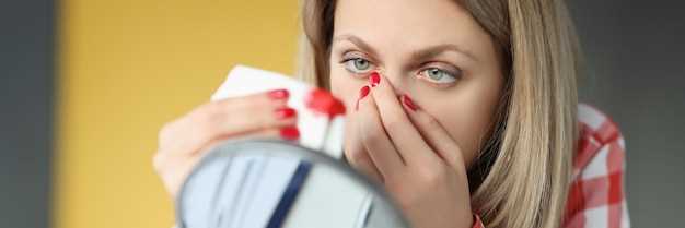 Роль сухости слизистой оболочки в появлении носового кровотечения